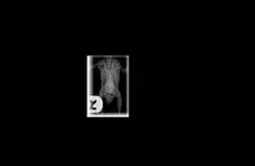 Kiwi XRay.webp