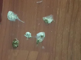 Poop question (WARNING: PICS)