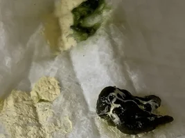 Another poop question, please help me! gross poop image*
