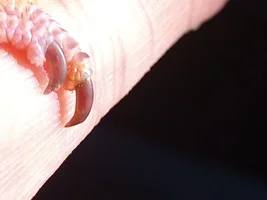 Help! Foot problem?