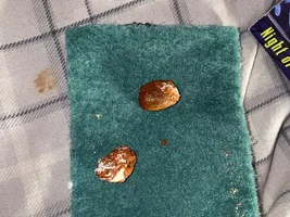 help! abnormal poop!