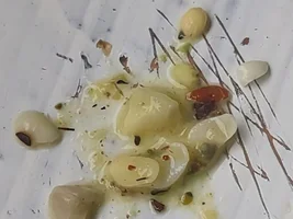 Vomiting..??