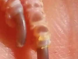 Help! Foot problem?