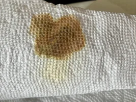 change in urine color! please lend any advice, vet closed till monday!