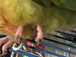 Accidental nail torn off