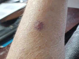 Baby conure bites waay too hard!