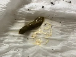baby gray has diarrhea