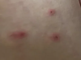 Wasps