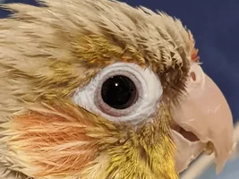 Eye swelling?