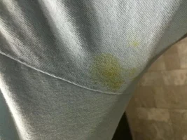 Is my conure vomitting or regurgitating?