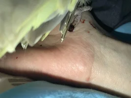 How to help Loki accommodate for his toe?