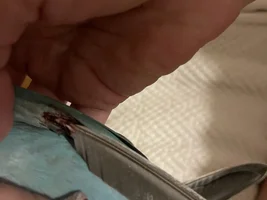 Broken wing