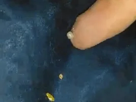 White egg type thing in millet?