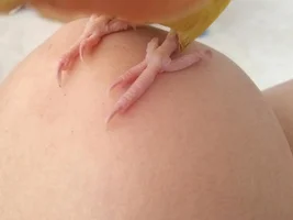 Is this just discoloration?