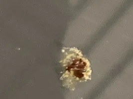 Help❗️Strange Dropings