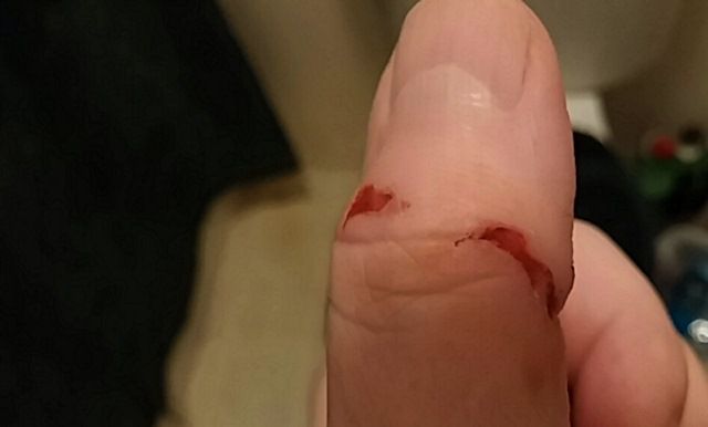 Bite3.jpg